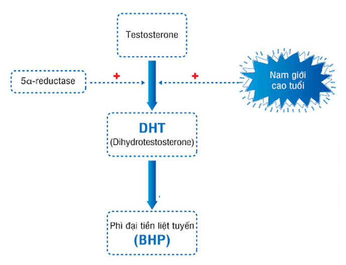 DHT- Nguyên nhân trực tiếp gây u xơ tuyến tiền liệt