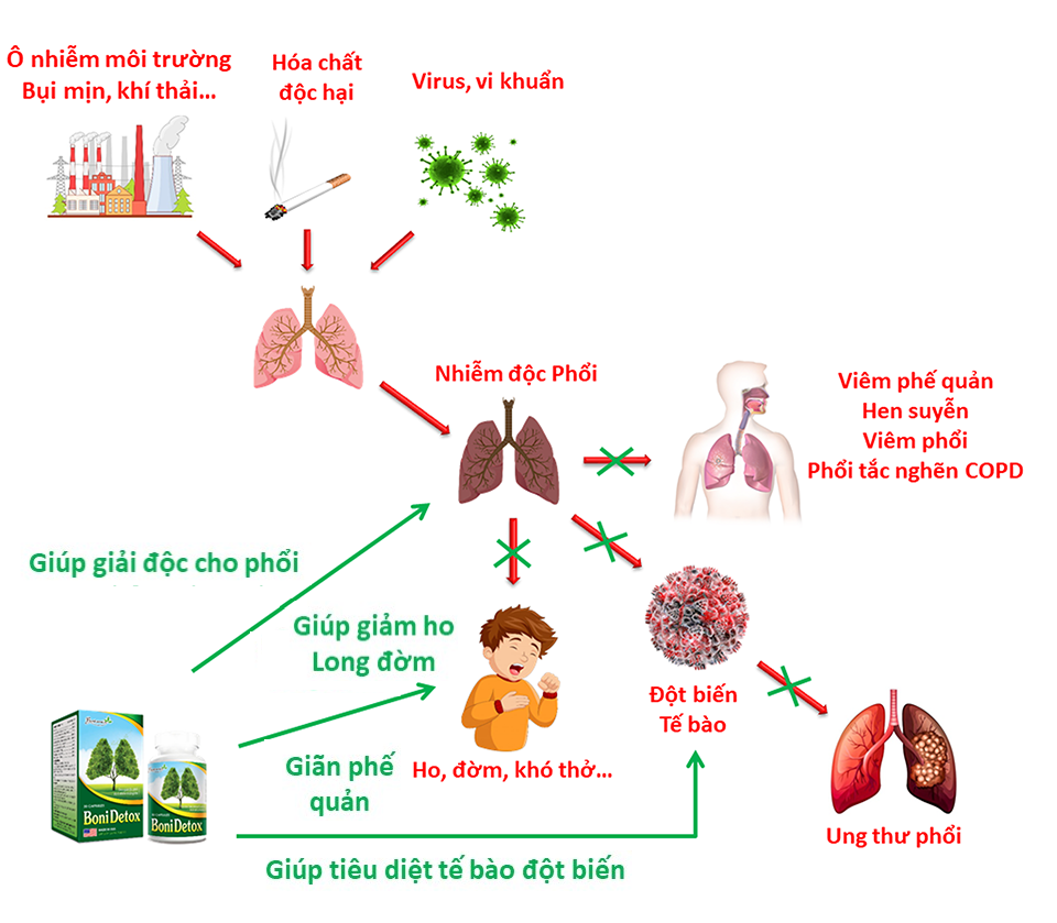 BoniDetox – Bí kíp vàng hỗ trợ giải độc phổi và giảm nguy cơ u bướu phổi của Mỹ - 3