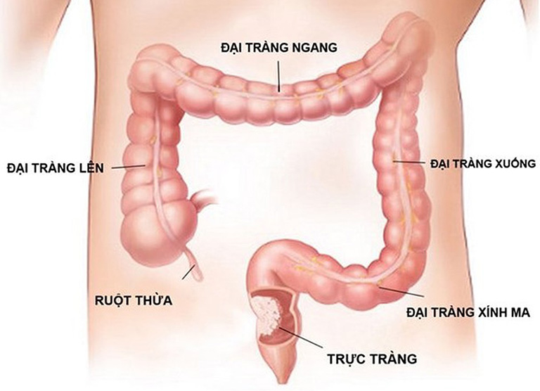 Hình ảnh đại tràng