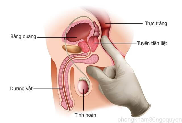 Những bệnh lý hay gặp ở tuyến tiền liệt